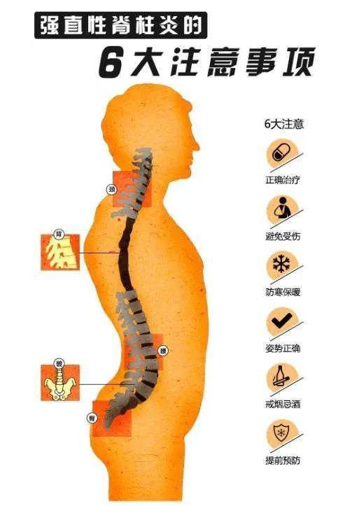 強(qiáng)直性脊柱炎可不可怕？從張嘉譯的現(xiàn)狀看疾病的真實(shí)面貌